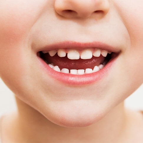 closeup of child's teeth
